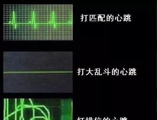 乱斗老司机出装攻略（以王者荣耀乱斗模式为例，教你如何选择出装，提高胜率）